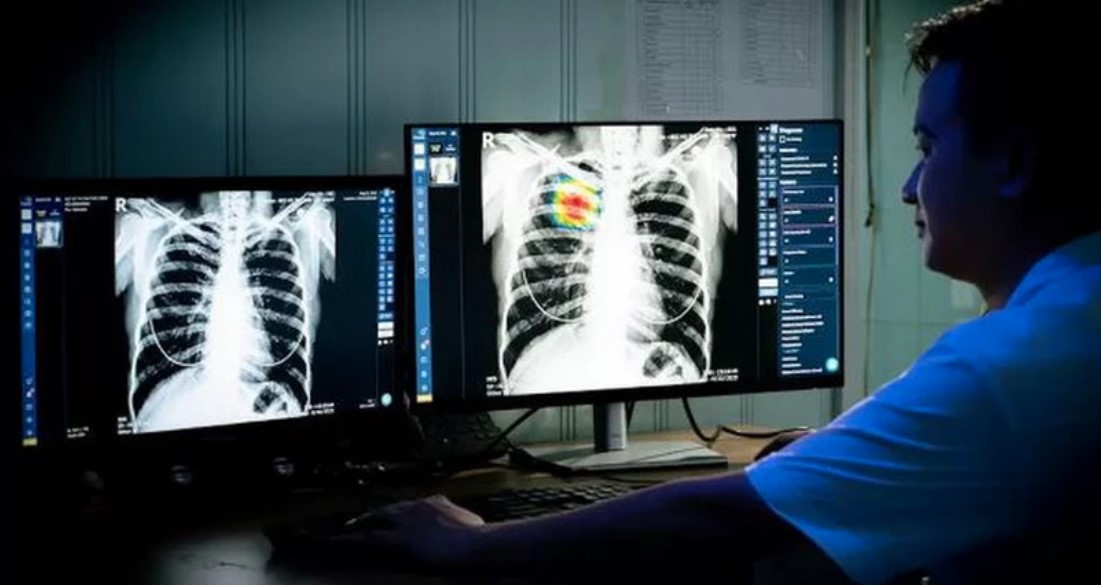 Nga ứng dụng Trí tuệ Nhân tạo trong chẩn đoán X-quang để xác định 54 bệnh