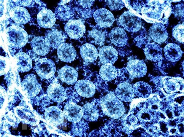 (Hình ảnh do Viện Y tế Quốc gia Mỹ (NIH) cung cấp) Virus SARS-CoV-2 chụp qua kính hiển vi điện tử trên mẫu bệnh phẩm tại phòng thí nghiệm ngày 1/8