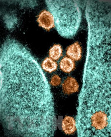 Hình ảnh virus SARS-CoV-2 chụp qua kính hiển vi điện tử tại phòng thí nghiệm ở Hamilton, Montana, Mỹ, ngày 28/6