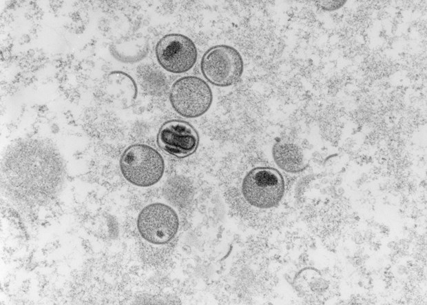 Hình ảnh virus đậu mùa khỉ dưới kính hiển vi điện tử tại phòng thí nghiệm thuộc Viện nghiên cứu và kiểm soát bệnh truyền nhiễm Robert Koch của Đức, ngày 23/5/2022